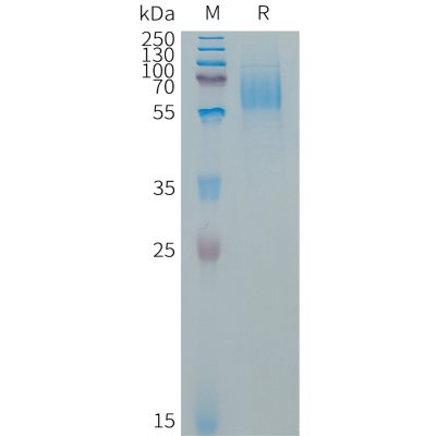 sp-PME101321 EGFRVIII Fig.1 SDS PAGE 1