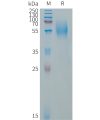 sp-PME101322 CD79A Fig.1 SDS PAGE 1