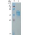 sp-PME101324 VWF Fig.1 SDS PAGE 1