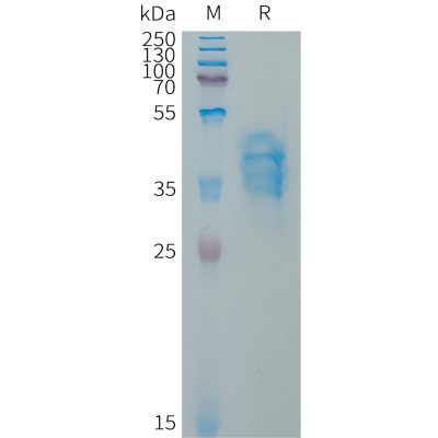 sp-PME101324 VWF Fig.1 SDS PAGE 1