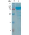 sp-PME101325 IL13RA2 Fig.1 SDS PAGE 1