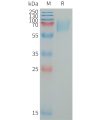 sp-PME101326 LILRA2 Fig.1 SDS PAGE 1