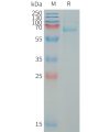 sp-PME101327 LILRB5 Fig.1 SDS PAGE 1