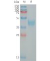 sp-PME101328 MXRA8 Fig.1 SDS PAGE 1