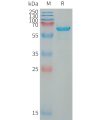 sp-PME101329 WFDC1 Fig.1 SDS PAGE 1