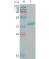 sp-PME101330 IGF1 Fig.1 SDS PAGE 1