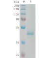 sp-PME101331 PIP Fig.1 SDS PAGE 1