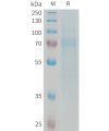 sp-PME101333 RTN4R Fig.1 SDS PAGE 1