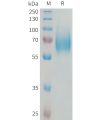 sp-PME101334 FGFR1 Fig.1 SDS PAGE 1