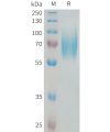 sp-PME101335 NTRK2 Fig.1 SDS PAGE 1