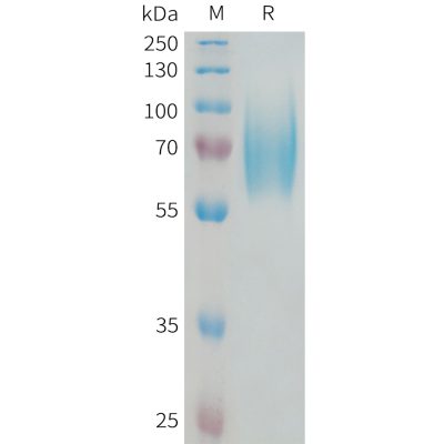 sp-PME101335 NTRK2 Fig.1 SDS PAGE 1