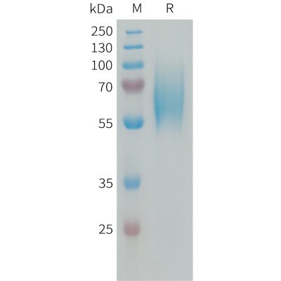 sp-PME101337 FGFR2 Fig.1 SDS PAGE 1