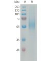 sp-PME101338 MSR1 Fig.1 SDS PAGE 1