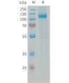 sp-PME101339 AOC3 Fig.1 SDS PAGE 1