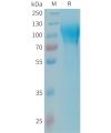 sp-PME101341 MAG Fig.1 SDS PAGE 1