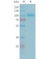 sp-PME101342 C2 Fig.1 SDS PAGE 1