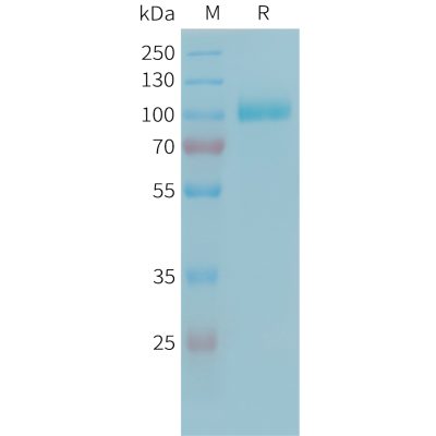 sp-PME101342 C2 Fig.1 SDS PAGE 1