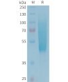 sp-PME101343 CX3CL1 Fig.1 SDS PAGE 1