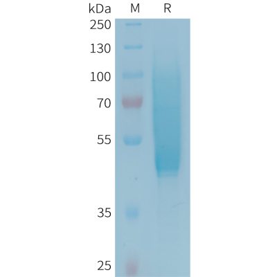 sp-PME101343 CX3CL1 Fig.1 SDS PAGE 1