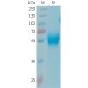 sp-PME101344 APOH Fig.1 SDS PAGE 1
