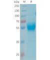 sp-PME101344 APOH Fig.1 SDS PAGE 1