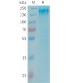 sp-PME101345 LEPR Fig.1 SDS PAGE 1