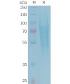 sp-PME101346 TREML2 Fig.1 SDS PAGE 1