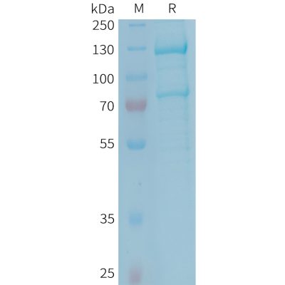 sp-PME101347 C5 Fig.1 SDS PAGE 1