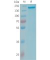 sp-PME101348 CFH Fig.1 SDS PAGE 1