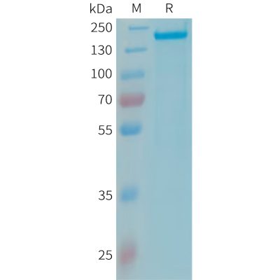 sp-PME101348 CFH Fig.1 SDS PAGE 1