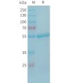 sp-PME101349 TREML1 Fig.1 SDS PAGE 1