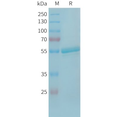 sp-PME101349 TREML1 Fig.1 SDS PAGE 1