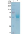 sp-PME101350 CD161 Fig.1 SDS PAGE 1