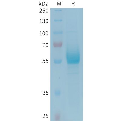 sp-PME101350 CD161 Fig.1 SDS PAGE 1