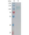 sp-PME101351 CD62E Fig.1 SDS PAGE 1