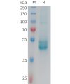 sp-PME101352 IL25 Fig.1 SDS PAGE 1