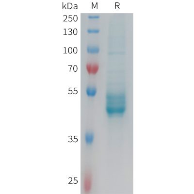 sp-PME101352 IL25 Fig.1 SDS PAGE 1