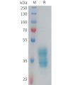 sp-PME101354 F2RL3 Fig.1 SDS PAGE 1