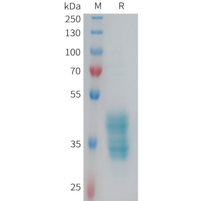 sp-PME101354 F2RL3 Fig.1 SDS PAGE 1