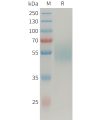 sp-PME101356 MICAa3 Fig.1 SDS PAGE 1