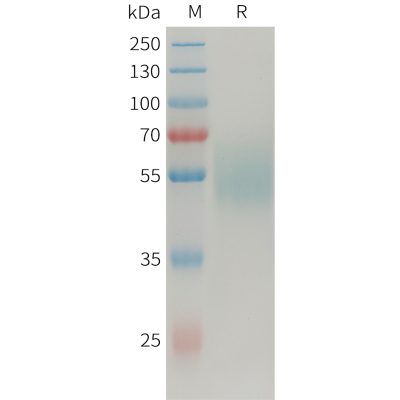 sp-PME101356 MICAa3 Fig.1 SDS PAGE 1