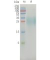 sp-PME101357 MICAa3 Fig.1 SDS PAGE 1