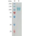 sp-PME101358 PDGFRA Fig.1 SDS PAGE 1