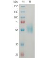 sp-PME101359 ST2 Fig.1 SDS PAGE 1