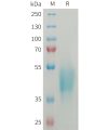 sp-PME101360 OSCAR Fig.1 SDS PAGE 1