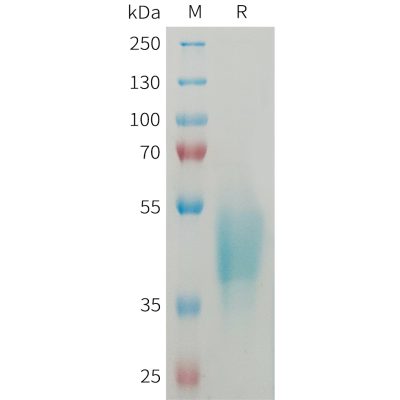 sp-PME101360 OSCAR Fig.1 SDS PAGE 1