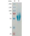 sp-PME101361 MADCAM1 Fig.1 SDS PAGE 1