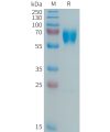 sp-PME101362 MMP8 Fig.1 SDS PAGE 1