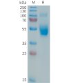 sp-PME101363 IL3 Fig.1 SDS PAGE 1