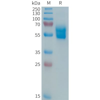 sp-PME101364 APO 1 Fig.1 SDS PAGE 1